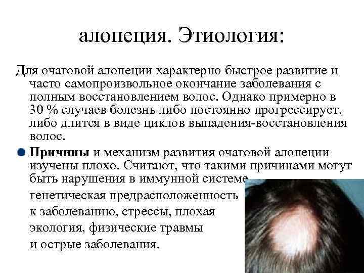 Выпадение волос у мужчин – лечение – публикации – лаборатория ан-тек
