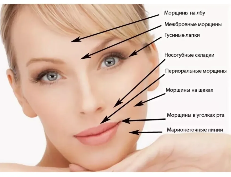 Как убрать мимические морщины