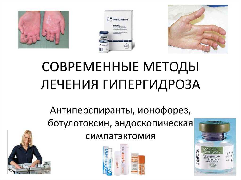Что делать, если сильно потеет лицо? – медицинский портал