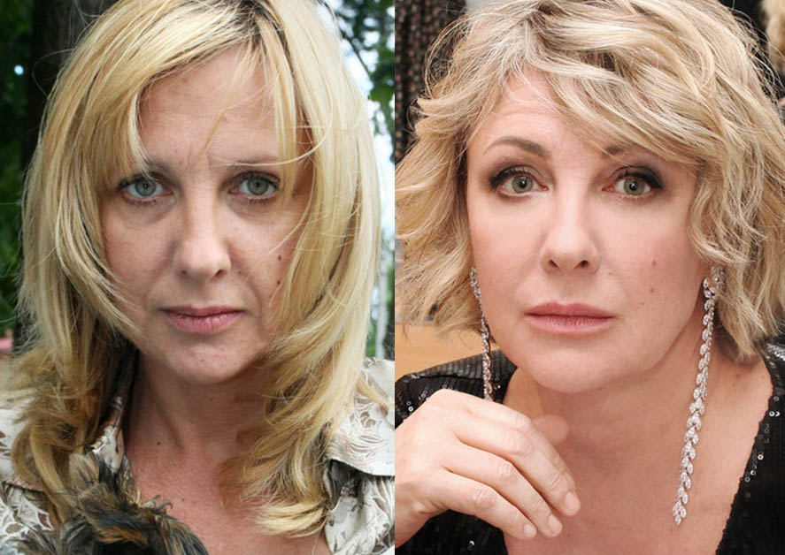 Актрисы до и после пластики фото российские