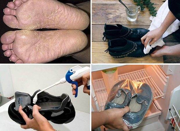 Чем обработать обувь от грибка ногтей - самые эффективные способы