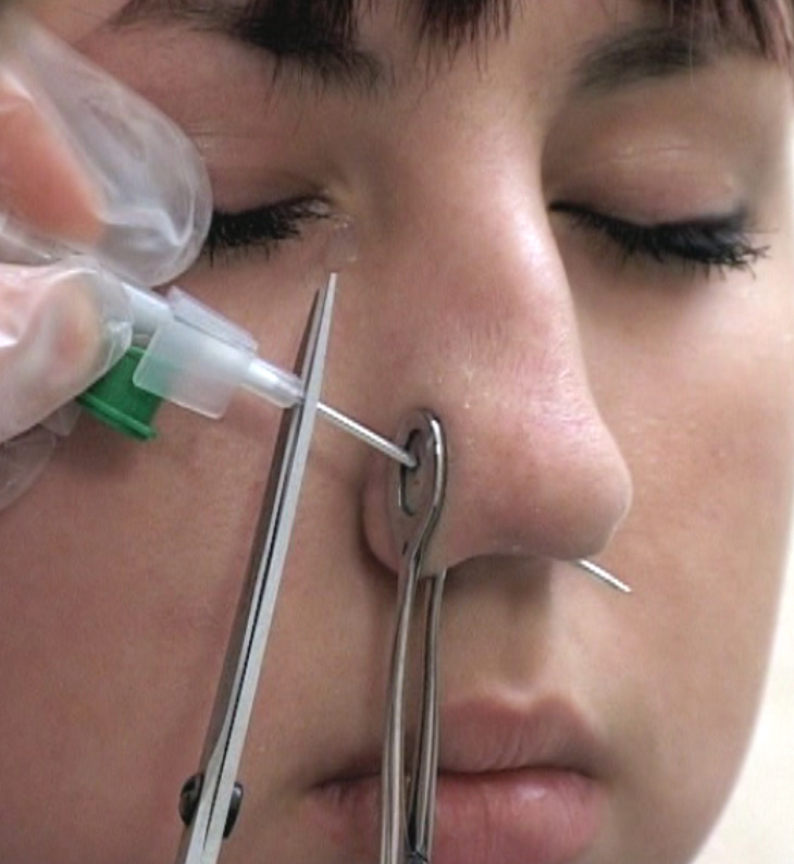 Пирсинг носа: как проводится процедура, возможные осложнения, правильный уход