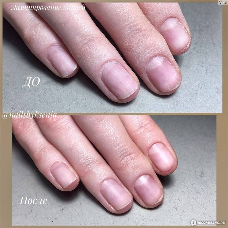 Восстановление ногтей после гель лака — это не работает