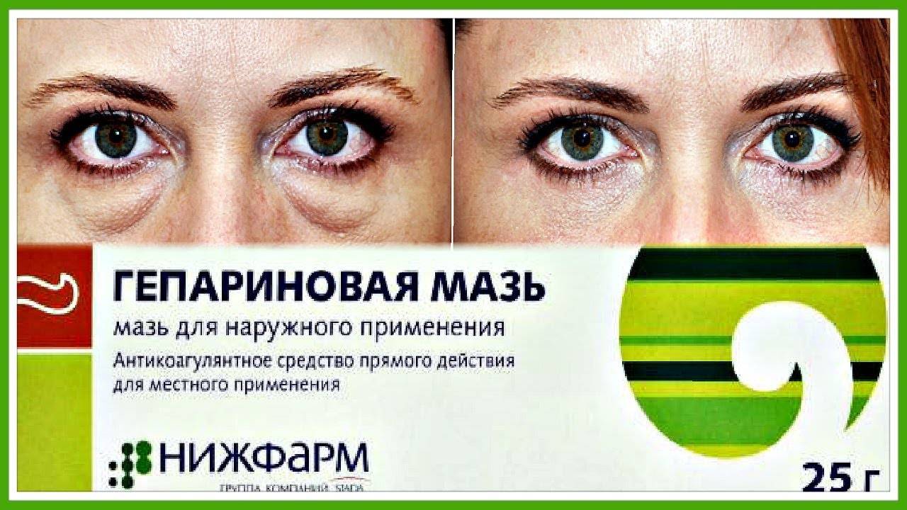 Реабилитация (восстановление) после блефаропластики | александр маркушин пластический хирург