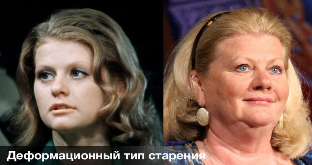 Морфотипы старения: разные подходы в коррекции на примере клинических случаев | портал 1nep.ru