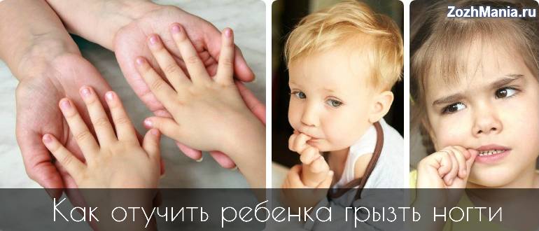 Как отучить ребенка грызть ногти на руках: что нужно делать, можно ли покрыть их лаком, а также каковы основные причины, почему это происходит и советы психолога