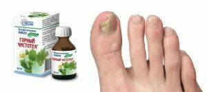 Лечение грибка ногтей на ногах маслом чистотела