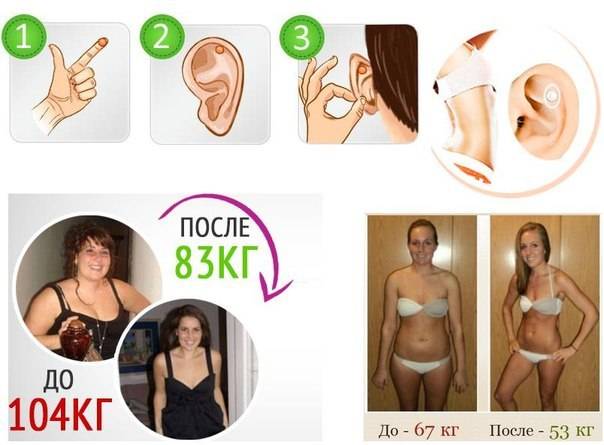 Изолятор для магнита и экранирование магнитного поля