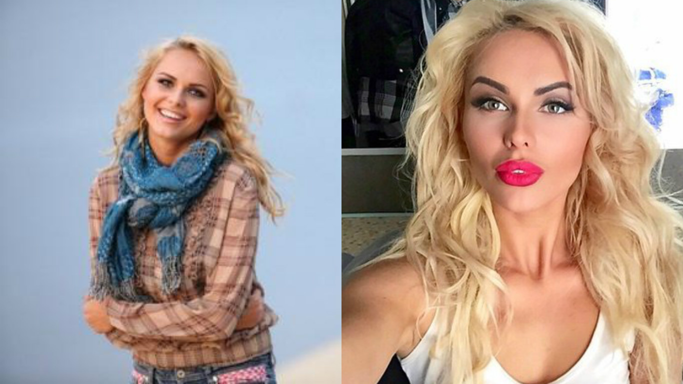 Ханна до и после пластики – фото певицы и биография | ddick.ru