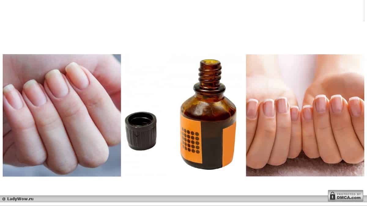 Йод для укрепления ногтей: можно ли им мазать пластины, как это правильно делать, и способы применения в домашних условиях