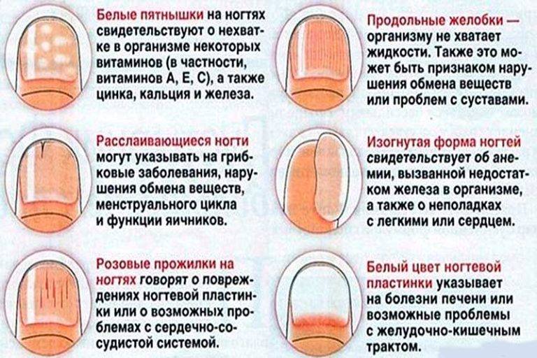Неприрастающий ноготь | центр подологии и остеопатии татьяны красюк