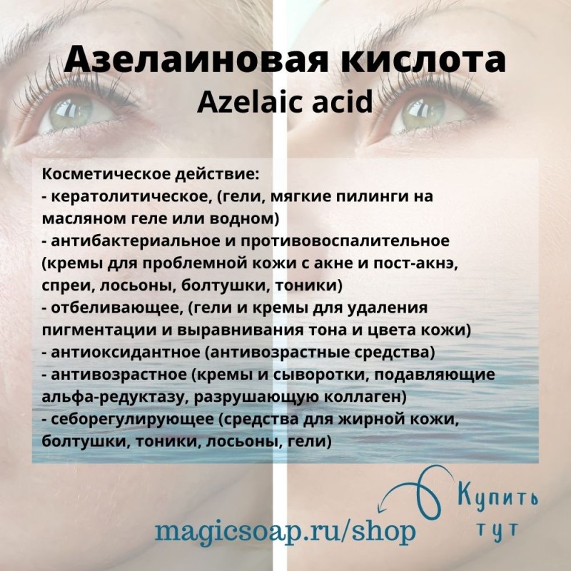 Мази с азелаиновой кислотой для лица. Прим. Крем от акне с азелаиновой кислотой. Азелаиновый пилинг bioplasma. Азелаиновая кислота действие.