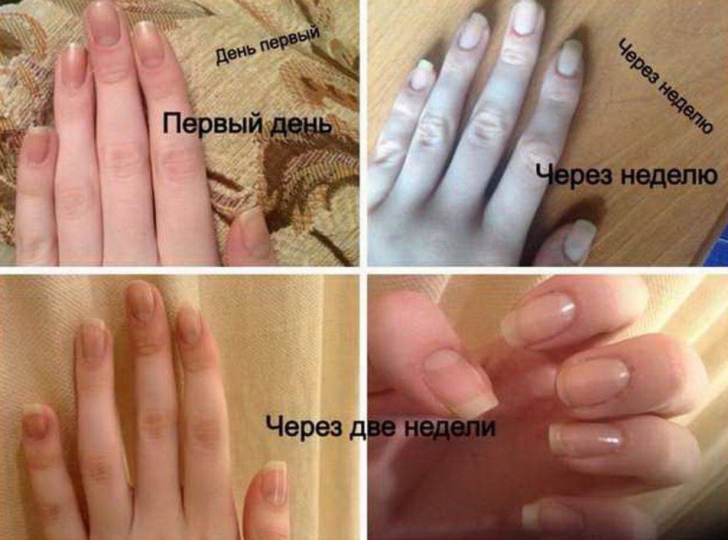 Строение ногтя и ногтевой пластины, как быстро растут ногти
