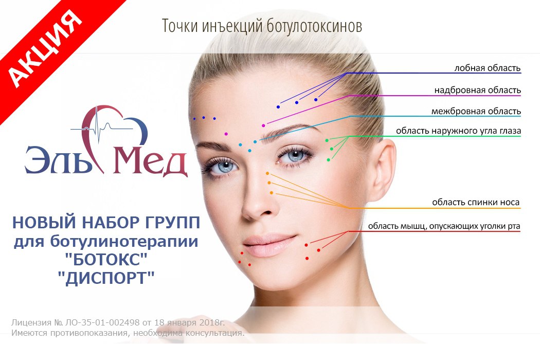 Лицо как у супермодели: что нужно знать о «подтяжке манекенщицы» - пластический хирург доктор белый