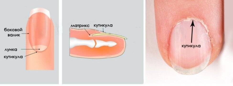 Воспаление кутикулы - что нужно знать мастеру маникюра и клиенту