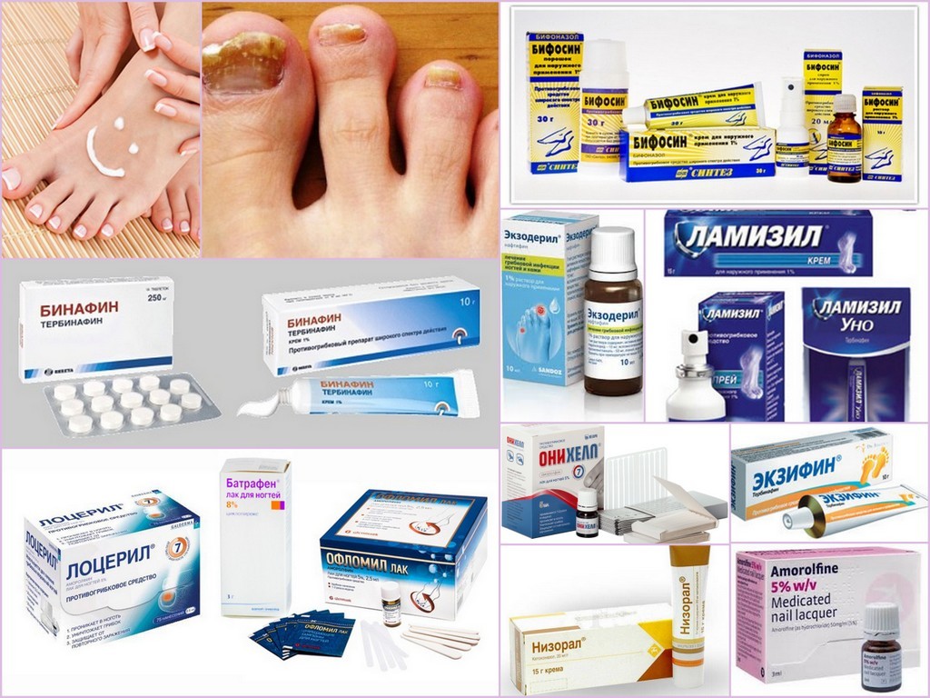 Рейтинг препаратов: 10 лучших мазей от грибка ногтей на ногах
