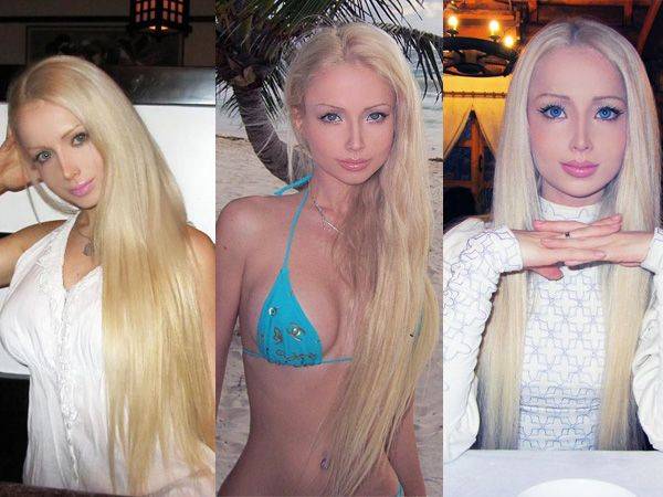 Валерия лукьянова до и после пластики: как выглядела «одесская барби» перед операциями (фото)