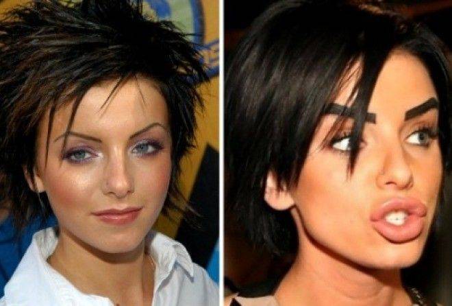  юлия рутберг сделала пластическую операцию: как сейчас выглядит актриса- фото до и после +видео