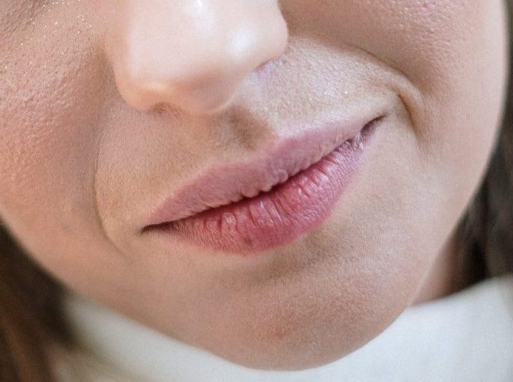 Сухая кожа вокруг рта: причины и лечение