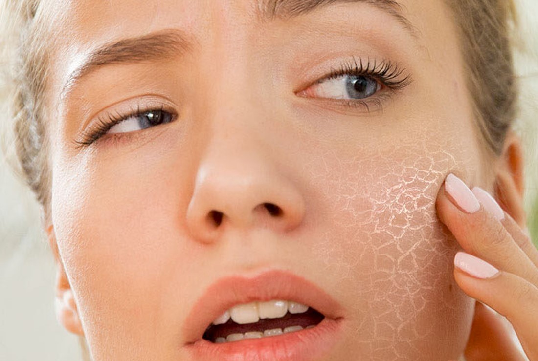 Почему шелушится кожа: внешние и внутренние факторы.