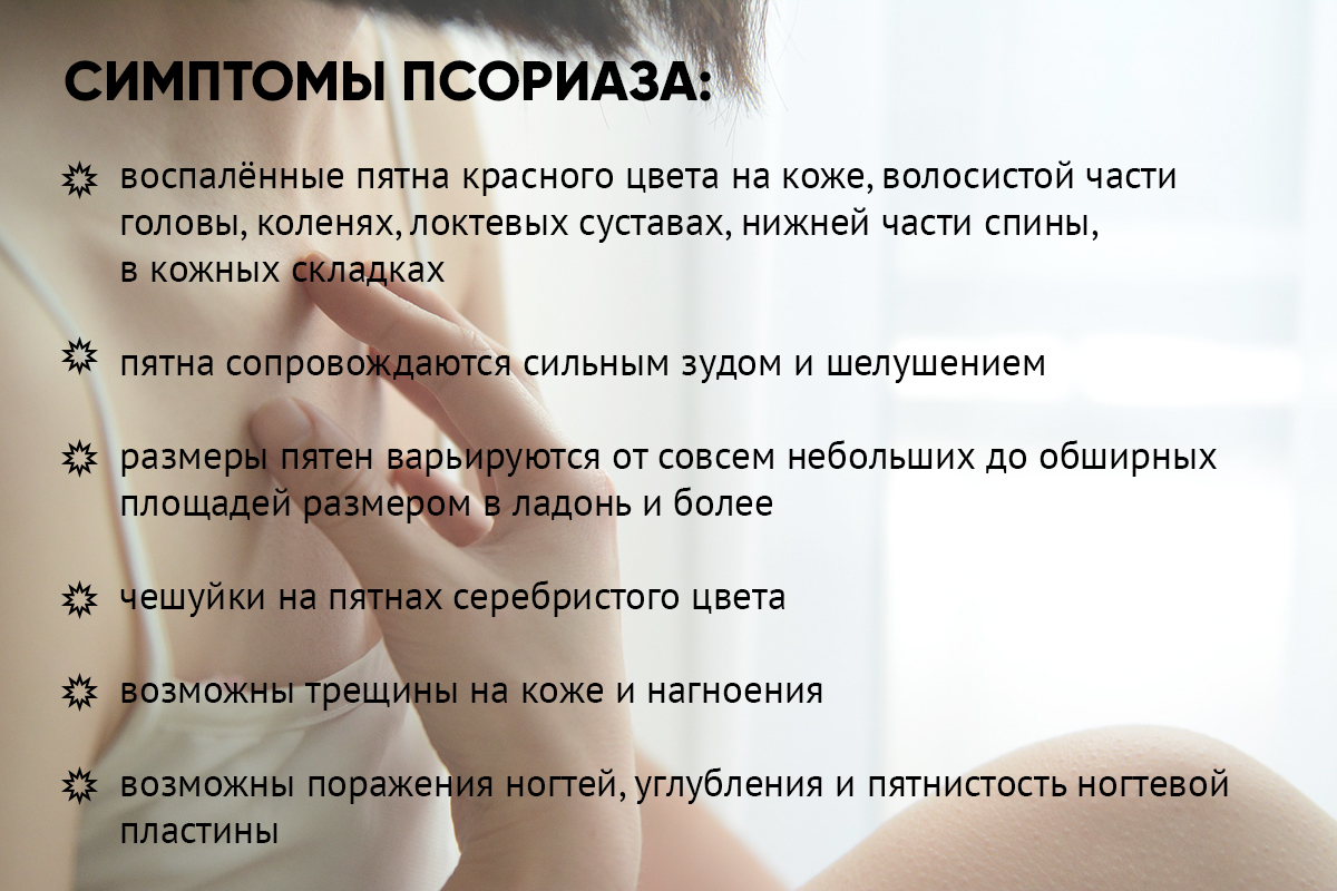 Псориаз волосистой части головы: причины возникновения и способы лечения | портал 1nep.ru