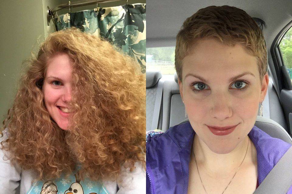Как восстановить волосы после химиотерапии, когда начинают расти, маски и охлаждение, ускорение роста