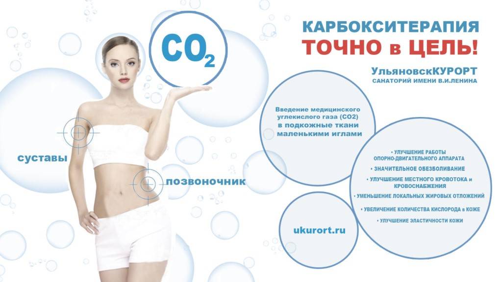 Карбокситерапия