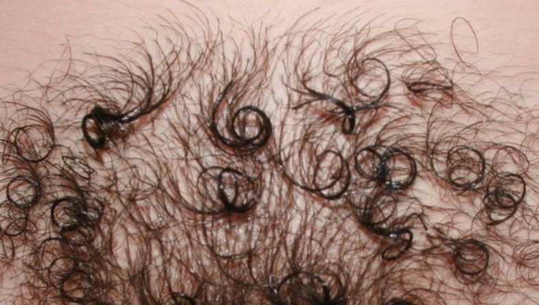 Волосы на теле что они значат