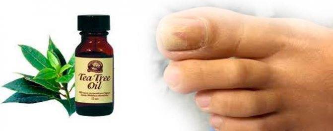 Эфирные масла против грибка ногтей: подборка лучших
