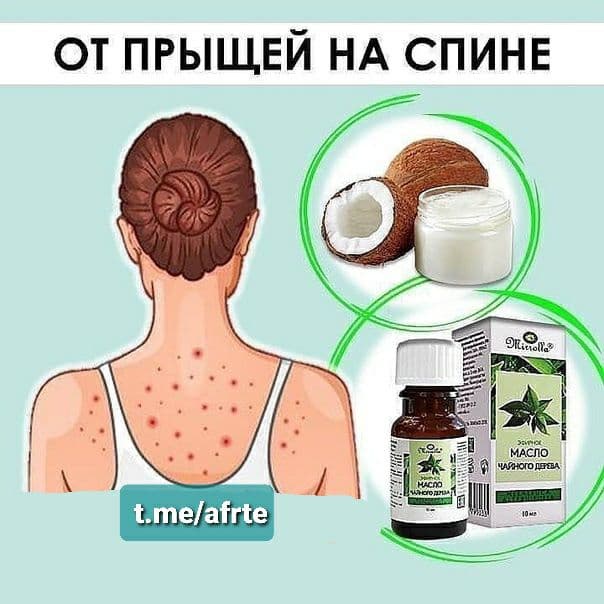 Прыщи на попе у женщин: причины и лечение в домашних условиях