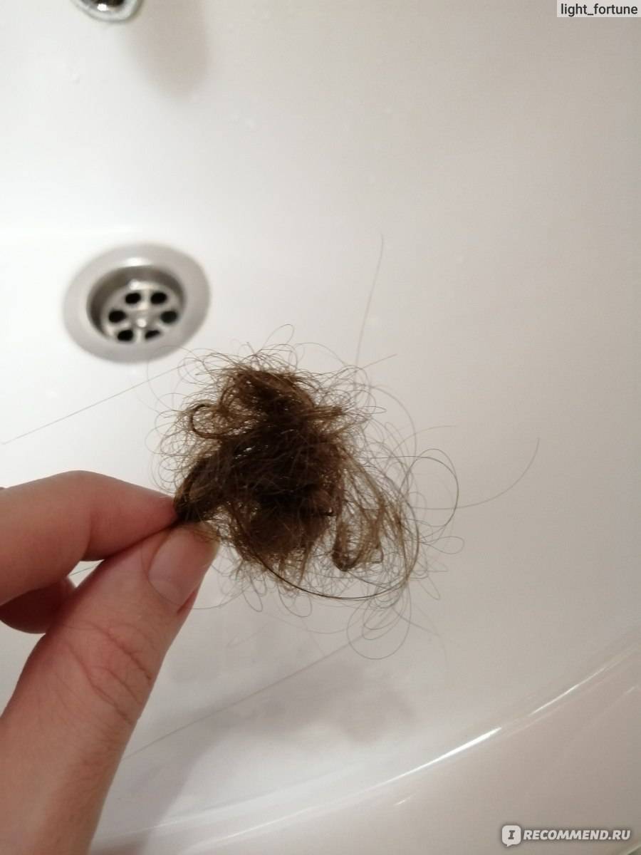Норма выпадения волос в день при расчесывании и мытье