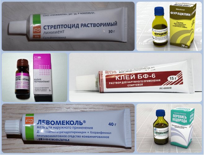 Мази от натоптышей и кремы для удаления сухих мозолей на ступнях: кератолитические, на основе мочевины либо салициловой кислоты - от эйвон, school и других марок