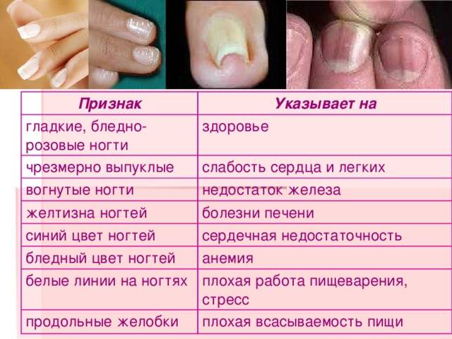 Ломкие ногти у детей: причины, профилактика и лечение