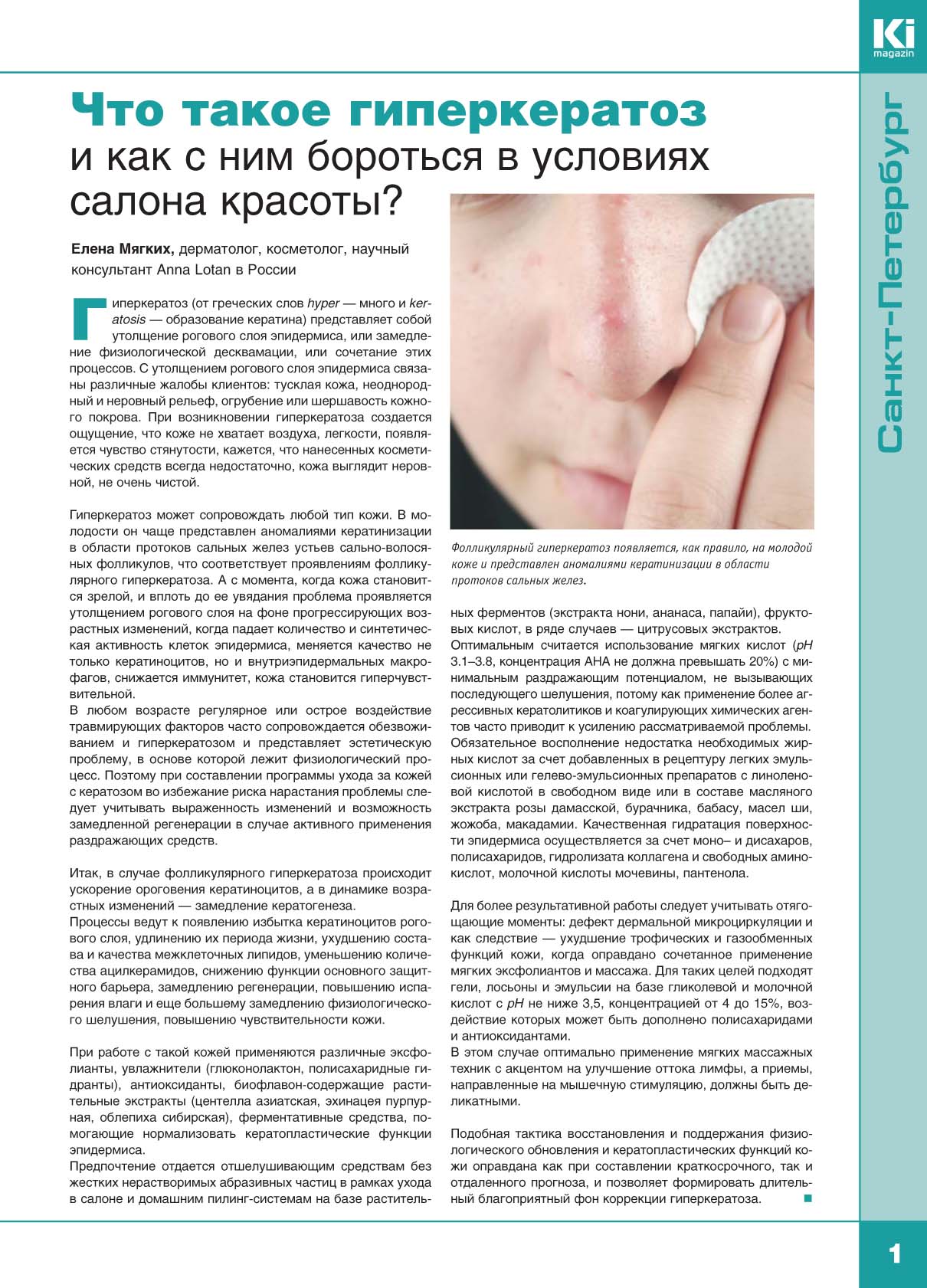 Гиперкератоз кожи лица: что это такое, симптомы, виды, лечение