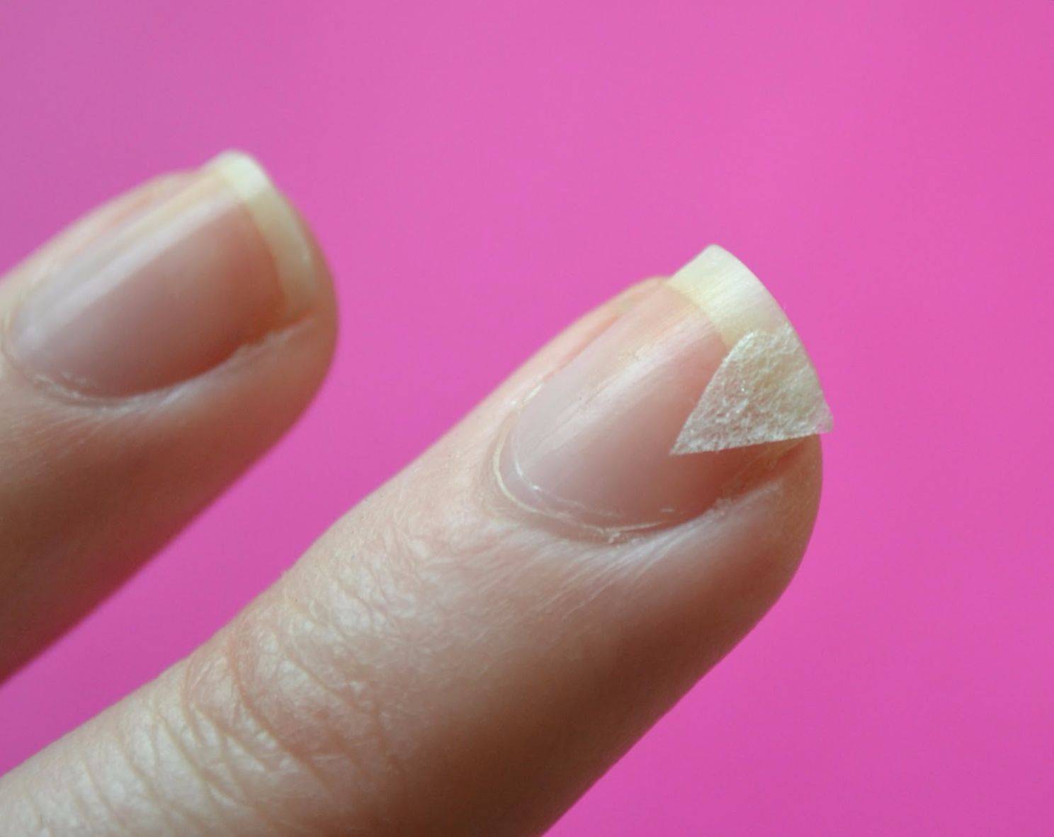 Почему слоятся ногти и как их укрепить