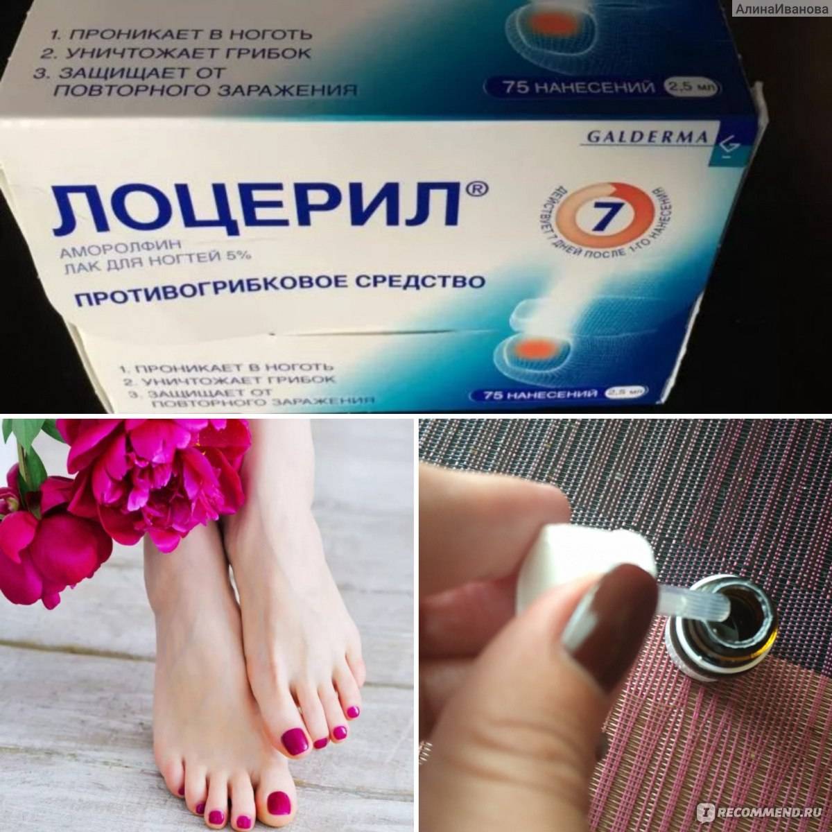 Противогрибковые препараты для ног и ногтей | азбука здоровья