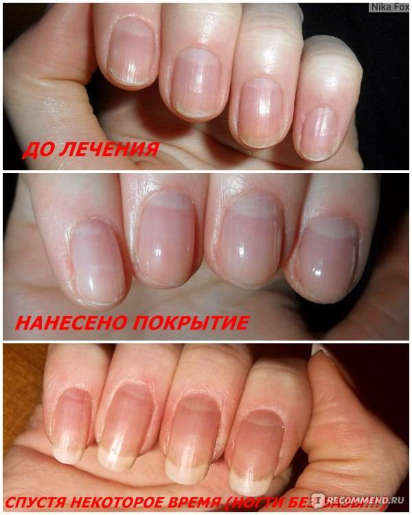 Асимметрия на ногтях: ногти разной формы | красивые ногти - дополнение твоего образа