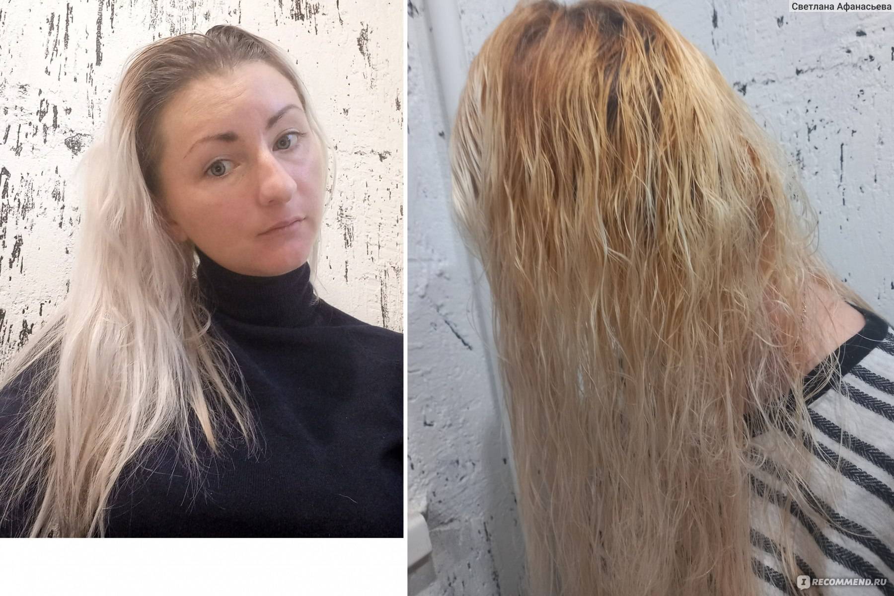 Как отрастить волосы после сожжения