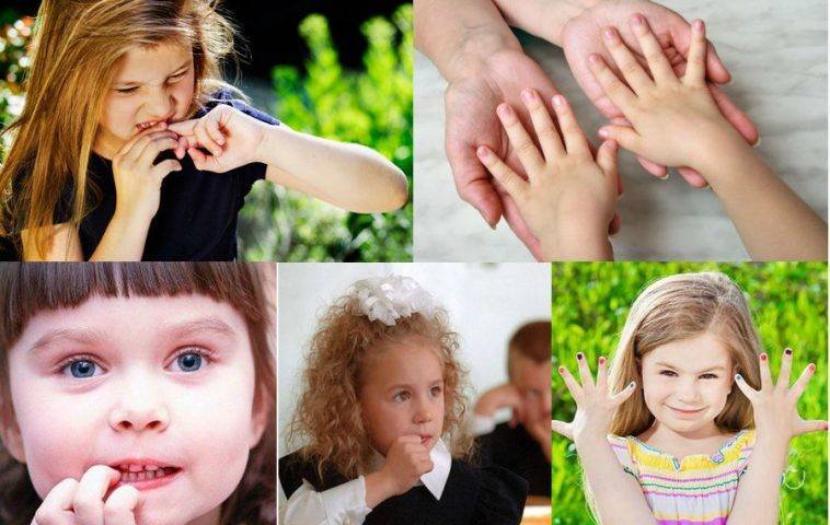 Как отучить ребенка грызть ногти: причина нарушения, народные рецепты и рекомендации психологов