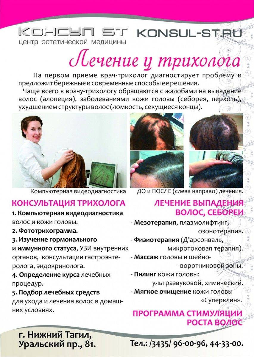 Алопеция у женщин – причины и лечение - медком