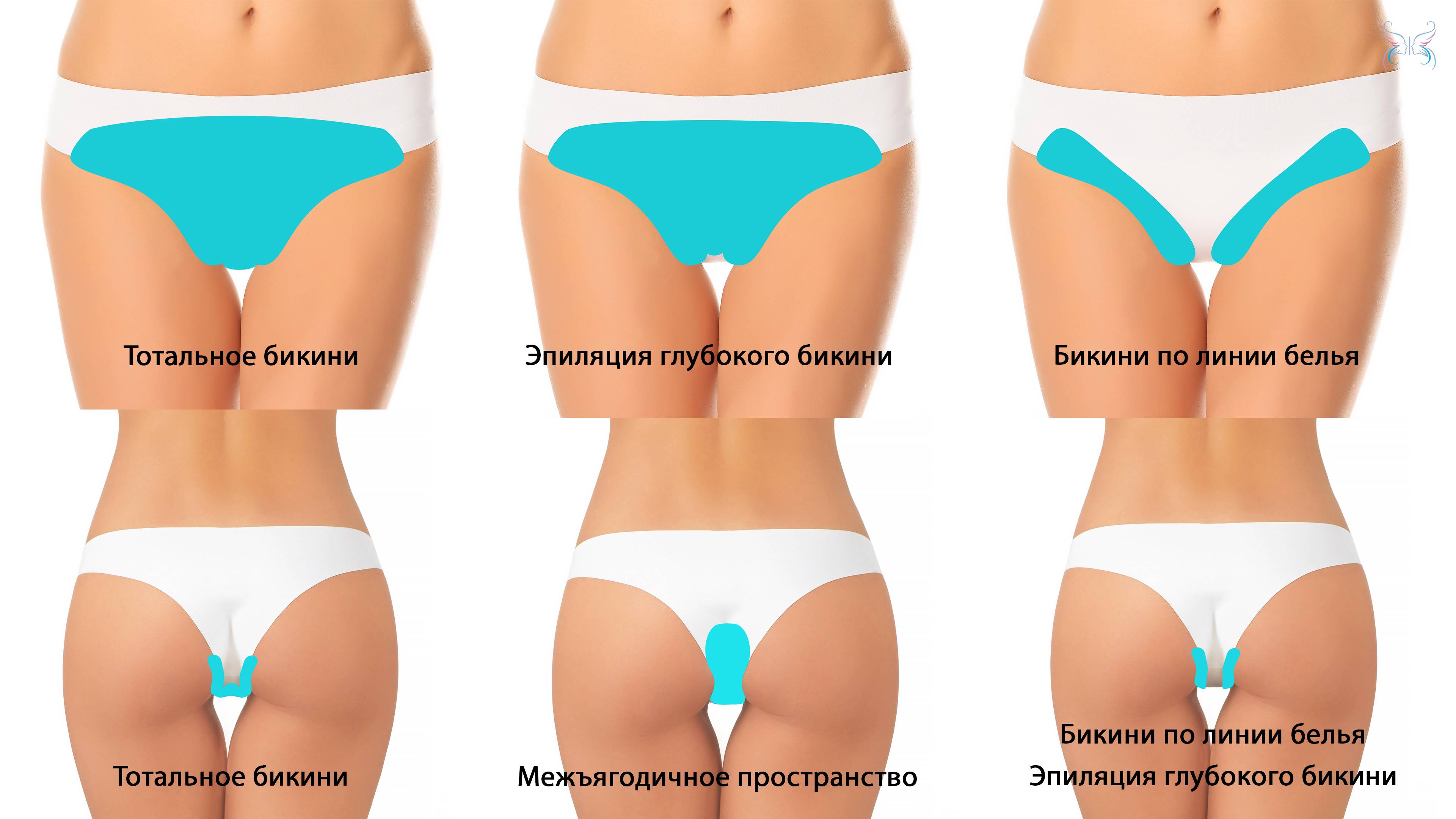 Шугаринг самой себе глубокое бикини