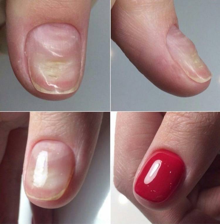 Как восстановить ногти после гель-лака: масла, кремы, процедуры с лечебным эффектом | vogue russia
