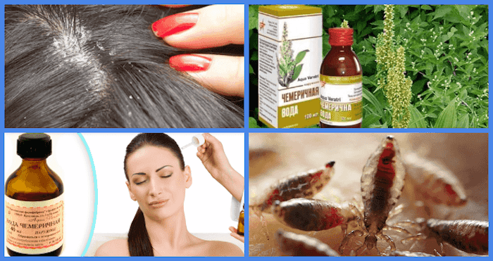 Как лечить волос на пальце народными средствами