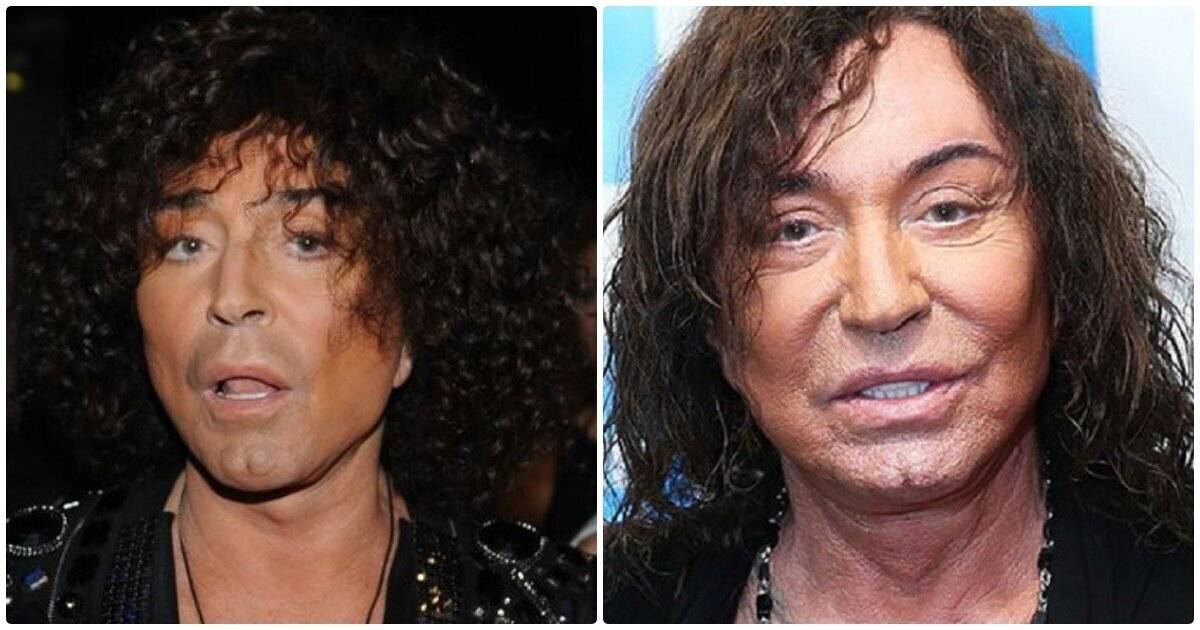 Актеры фото до и после пластики фото