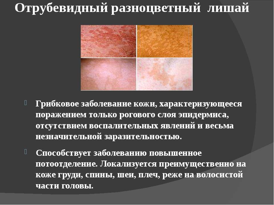 Нейродермит на лице