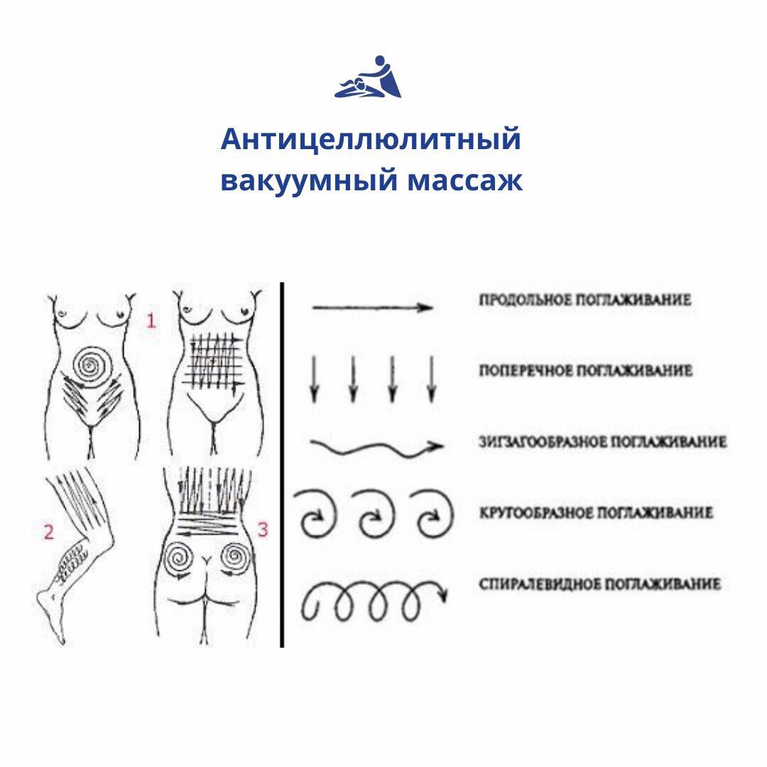 Банки для похудения живота, эффективность, как проводить | irksportmol.ru