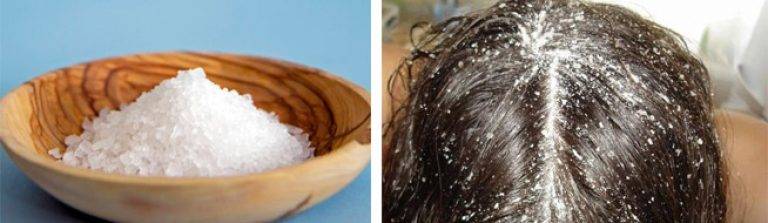 Соль для волос: вся польза — от выпадения, для роста, для укладки и еще