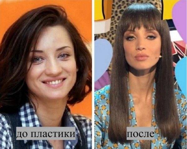 Татьяна Денисова до и после пластики. Горячие фото, биография