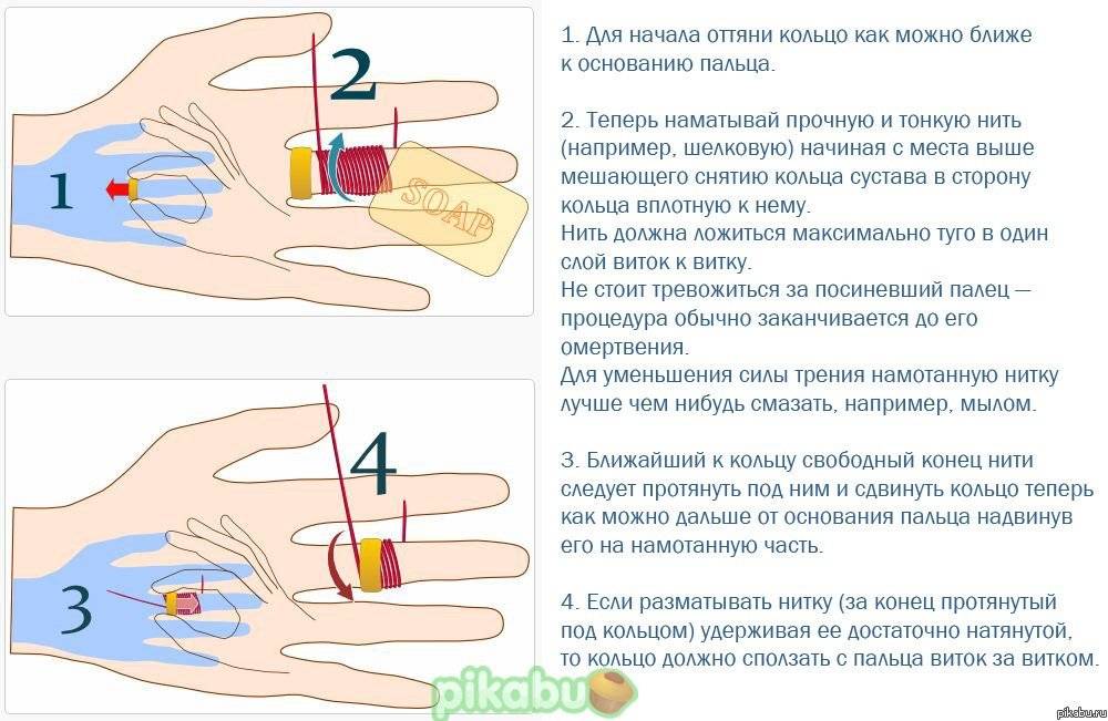 Как снять кольцо с опухшего и отекшего пальца: рабочий способ