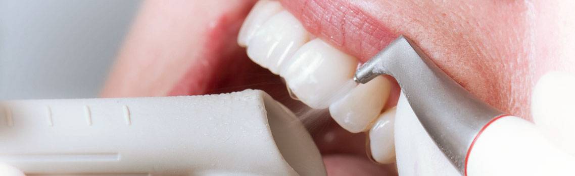 Чистка зубов air flow: очищение и осветление зубной эмали без вреда для здоровья, показания и противопоказания к применению, этапы процедуры, преимущества метода.